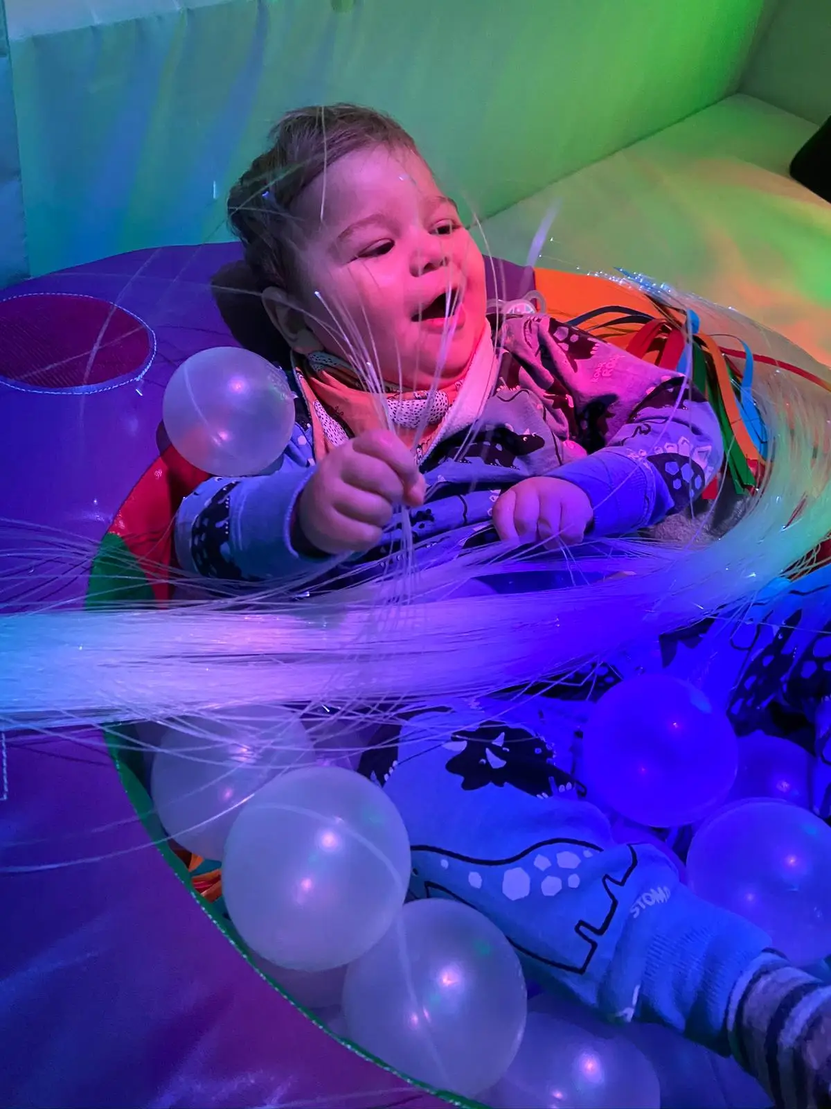 FOXG1 Syndrome Child in therapy