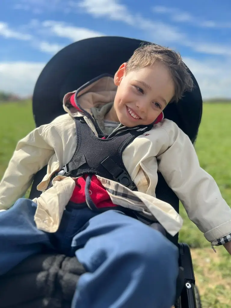 Child affected by FOXG1 syndrome